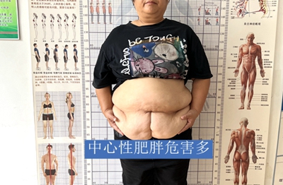 体重正常医生怎么还让你减肥？长春康达医院专家：小心中心性肥胖1.jpg