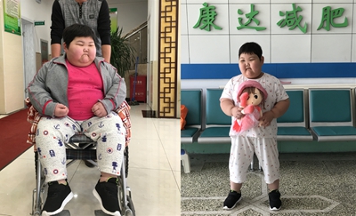 别让“可爱胖”影响孩子健康成长，五步告别“小胖墩”3.jpg